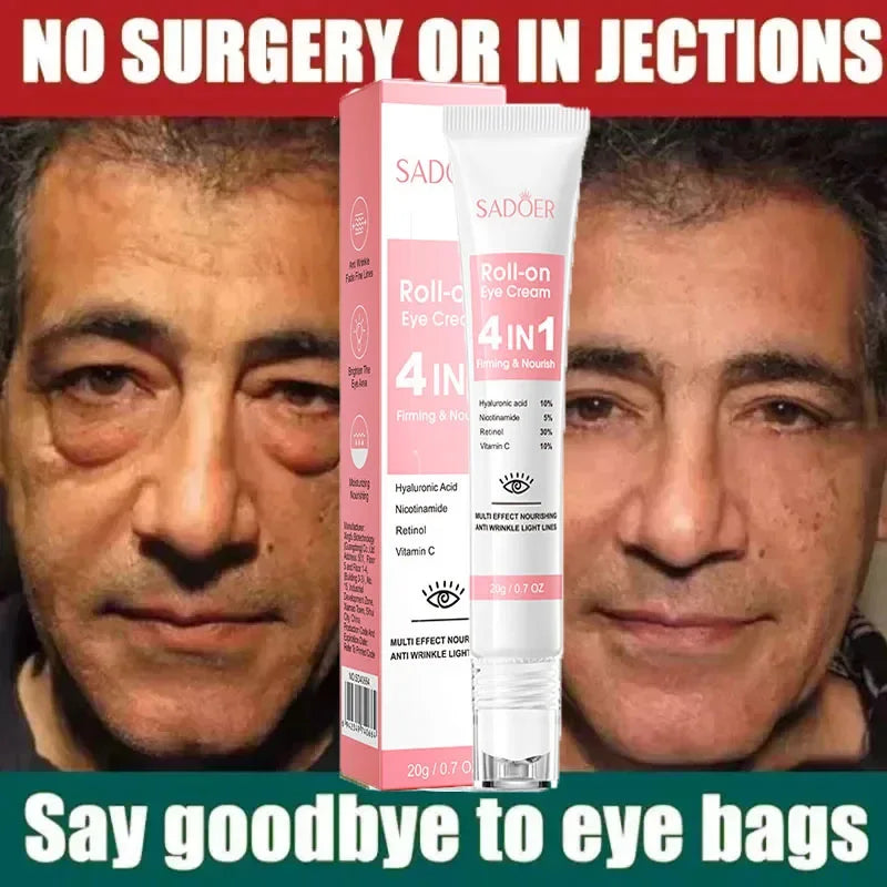 SADOER 4-in-1 Eye Roll-On Cream – Dark Circles, Puffiness, Wrinkles, Eye Bags & Hydrating Serum