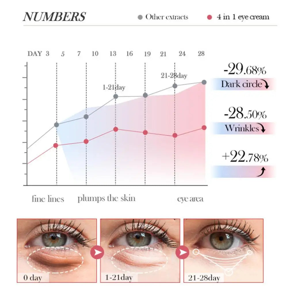 SADOER 4-in-1 Eye Roll-On Cream – Dark Circles, Puffiness, Wrinkles, Eye Bags & Hydrating Serum