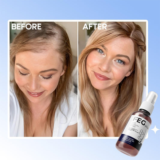 FEG RootRise Herbal Hair Essence – Promotes Growth, Strengthens Roots & Restores Fuller, Healthier Hair Naturally