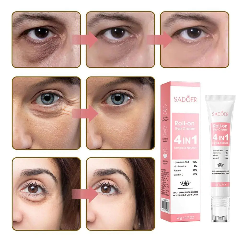 SADOER 4-in-1 Eye Roll-On Cream – Dark Circles, Puffiness, Wrinkles, Eye Bags & Hydrating Serum